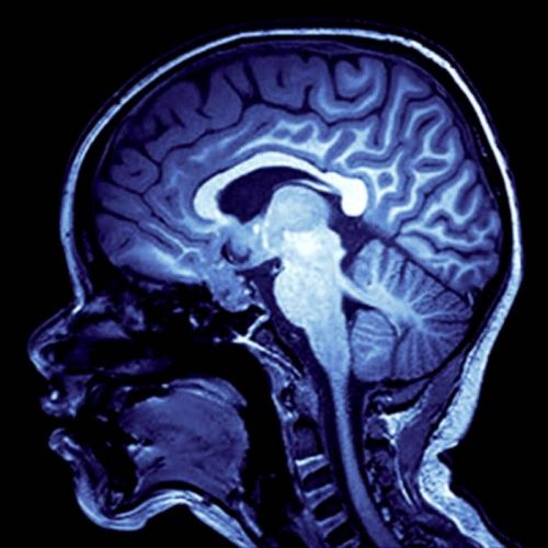 Skorched - Minds Taken [EP] (2017)