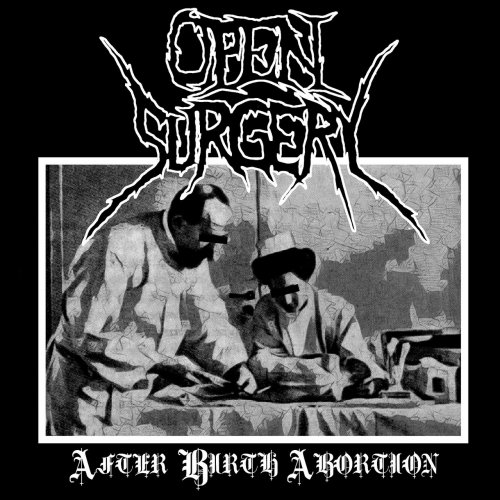 Open Surgery - After Birth Abortion (2018)