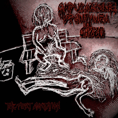 Amputazione Spontanea Del Cazzo - The First Amputation (2020)