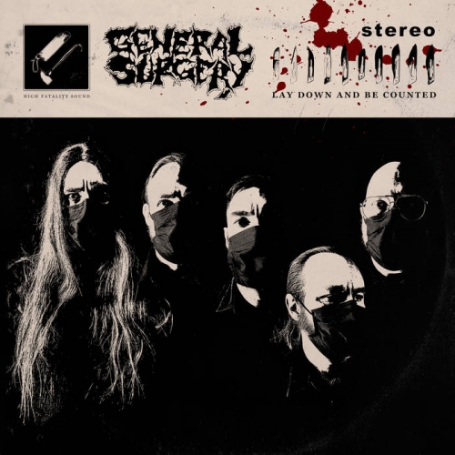 General Surgery - Lay Down and Be Counted (EP) (2021)