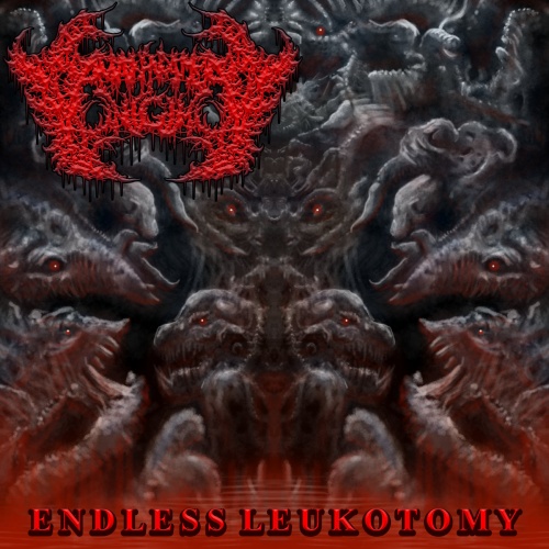 A Man Named Onigumo - Endless Leukotomy (2022)