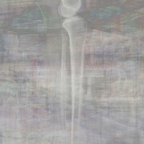 Glass Noose - Broken Leg Holiday (2022)