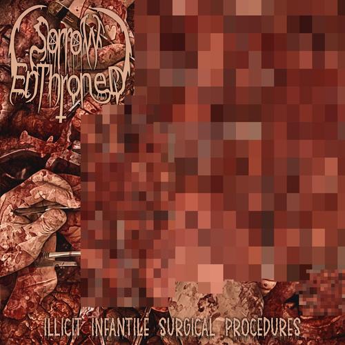 Sorrow Enthroned - Illicit Infantile Surgical Procedures (2023)