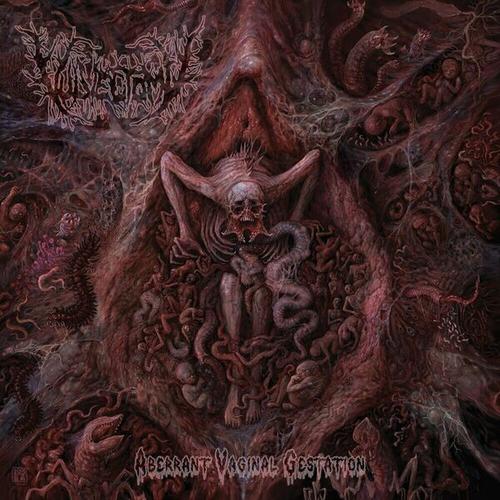 Vulvectomy - Aberrant Vaginal Gestation (2025) 320|FLAC