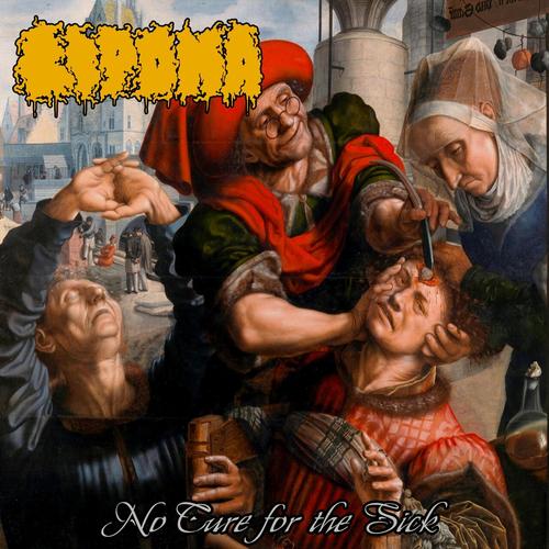 Lipoma - No Cure for the Sick (2025)